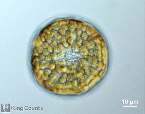 Photo of Asteromphalus heptactis